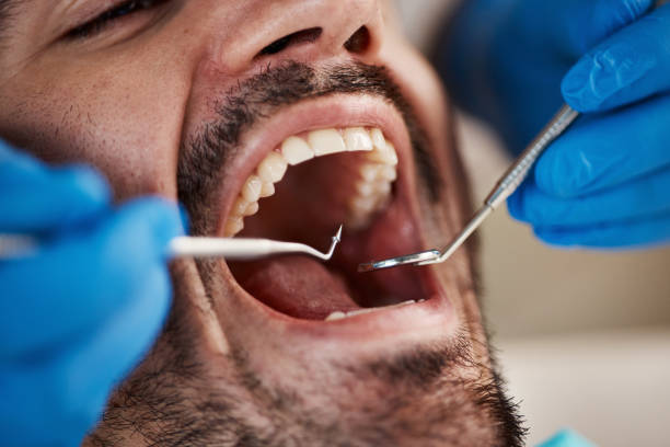 Best Laser Dentistry  in , DC