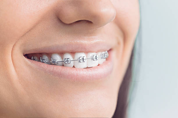 Best Invisalign and Clear Aligners  in , DC